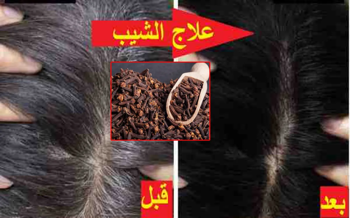 وصفة القرنفل للتخلص من الشيب والشعر الأبيض تماماً نتيجتها رائعة