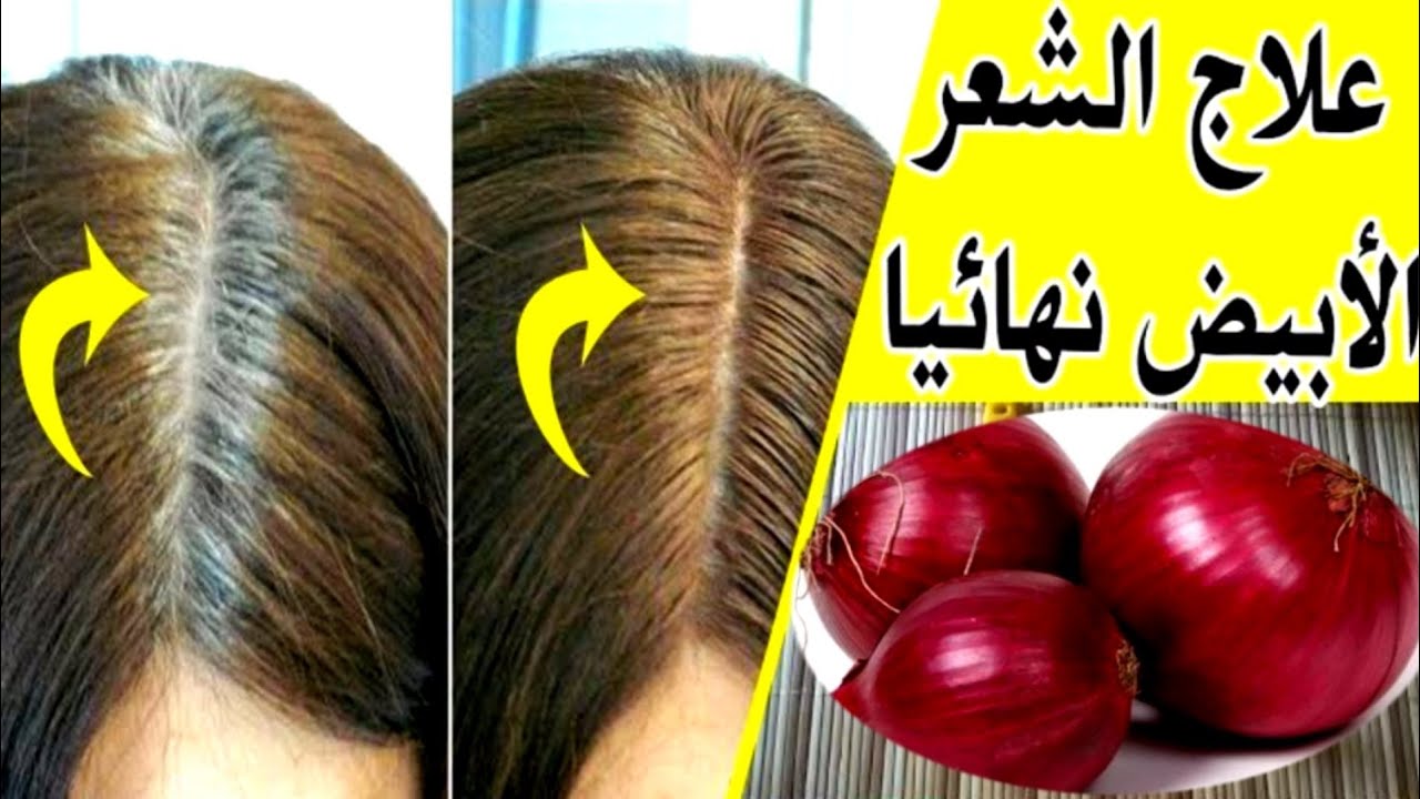 مش هتصدقي نفسك قشر البصل للتخلص من الشيب ومش هيبقى في وجود للشعر الأبيض 5 مش هتصدقي نفسك قشر البصل للتخلص من الشيب ومش هيبقى في وجود للشعر الأبيض