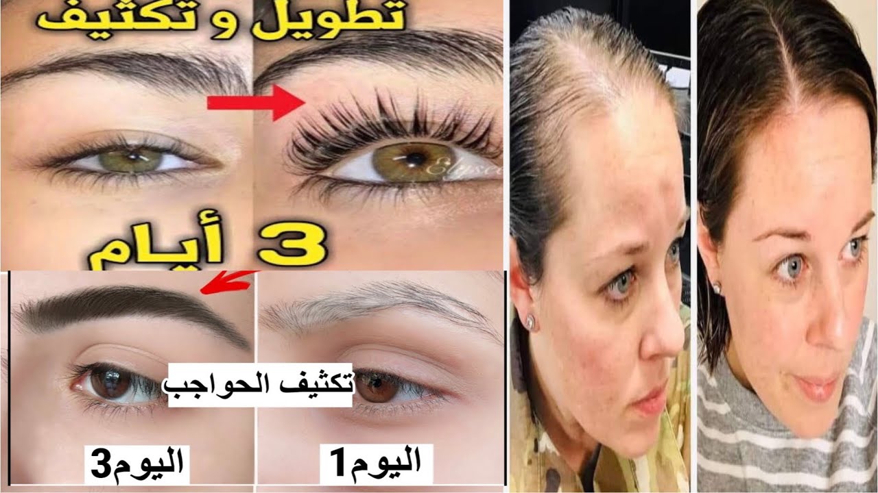 وصفة تكثيف الحواجب وإنبات الشعيرات بكل سهولة وبمكونات طبيعية 5 وصفة تكثيف الحواجب وإنبات الشعيرات بكل سهولة وبمكونات طبيعية
