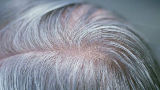 وصفة القرنفل للشعر الابيض ب 1/4 كوب زيت سمسم خلطة طبيعية لتقوية الشعر ومنع ظهور الشيب المبكر 5 وصفة القرنفل للشعر الابيض ب 1/4 كوب زيت سمسم خلطة طبيعية لتقوية الشعر ومنع ظهور الشيب المبكر