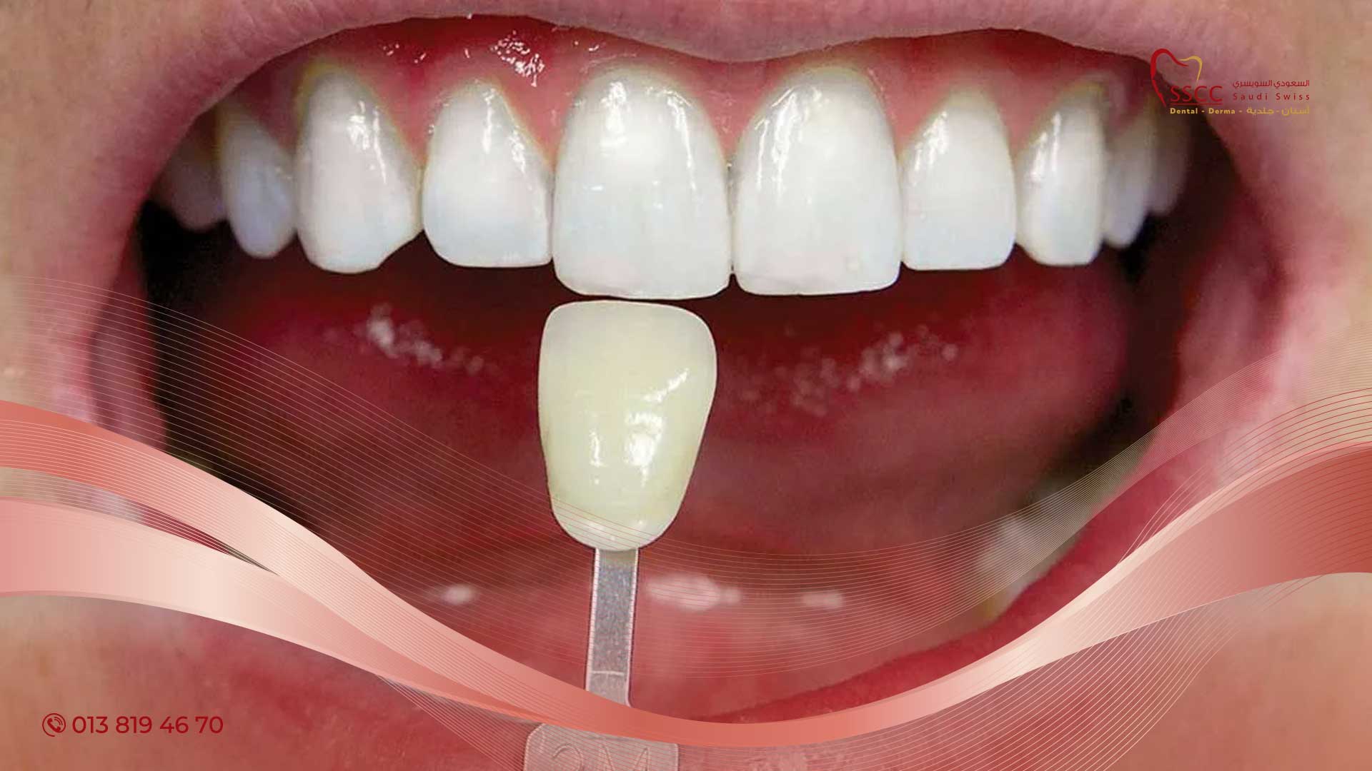 صدق أو لا تصدق.. تبيض الأسنان في 3 دقائق بمكونات من مطبخك بدون الحاجة إلى الدكتور 5 صدق أو لا تصدق.. تبيض الأسنان في 3 دقائق بمكونات من مطبخك بدون الحاجة إلى الدكتور
