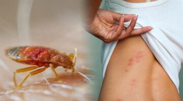 هيهرب من بيتك.. القضاء على بق الفراش وطرده فورا من المنزل بطريقه جهنميه وبدون كيماويات