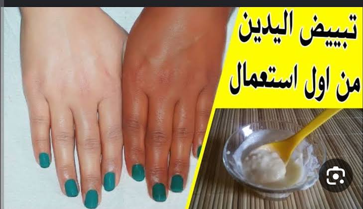 وصفة طبيعية وفعالة لتفتيح اليدين اكتشفي السر وراء يدين مشرقتين وجميلتين 5 وصفة طبيعية وفعالة لتفتيح اليدين اكتشفي السر وراء يدين مشرقتين وجميلتين