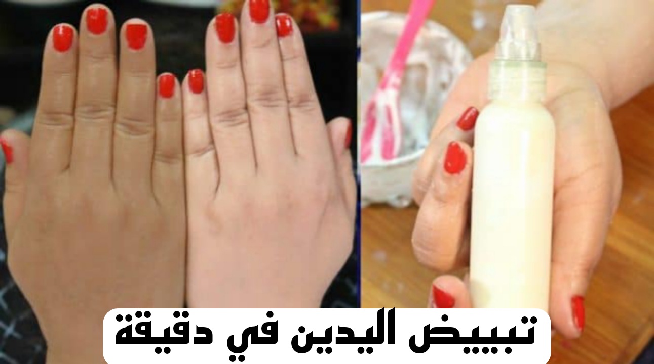 جربيها وهتنبهري..طريقة تبييض اليدين في دقيقة هتشوفي النتيجة بنفسك