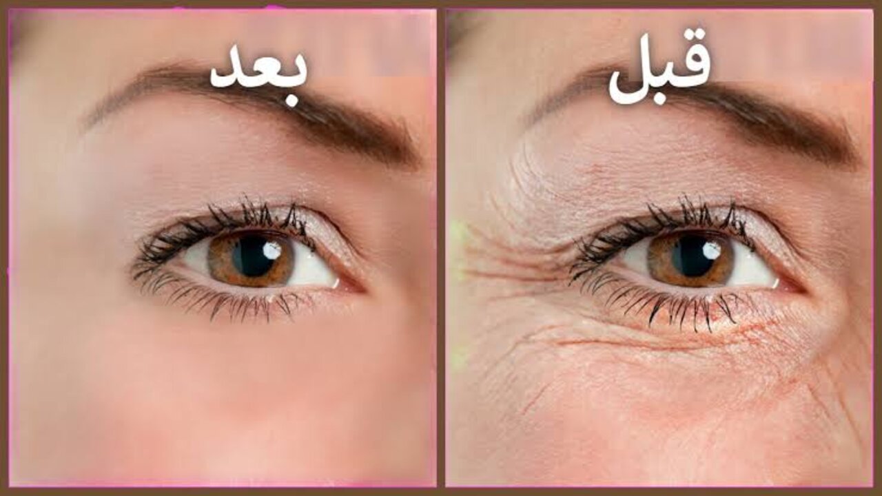 جمالك هيرجع تاني زي زمان.. كولاجين طبيعي استخرجيه بهذه الطريقة المدهشة