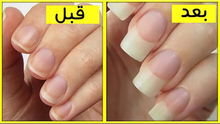 هتبقى أحسن من الصناعية.. خلطة جهنمية بمكونات طبيعية لتطويل الاظافر 5 هتبقى أحسن من الصناعية.. خلطة جهنمية بمكونات طبيعية لتطويل الاظافر