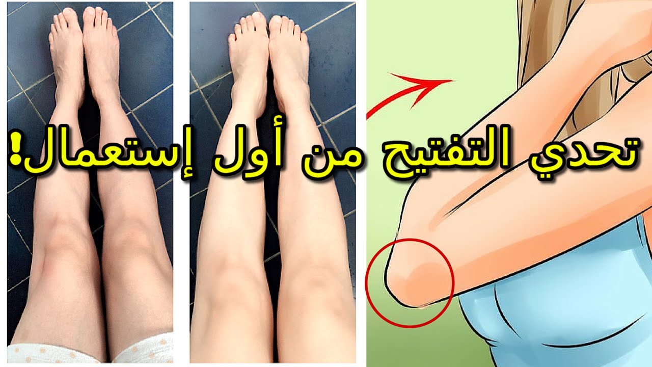 وصفة مذهلة لتفتيح وتنعيم الركب والأكواع من الاستعمال الأول