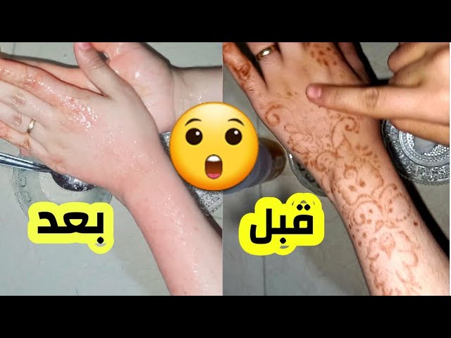 طريقة إزالة الحناء من اليد والجسم في ثواني فقط بمكونات طبيعية من مطبخك