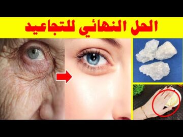 هتخليكي عروسه! وصفه التخلص من التجاعيد وشد البشرة بطريقة طبيعيه هتزيل ترهلات السنين