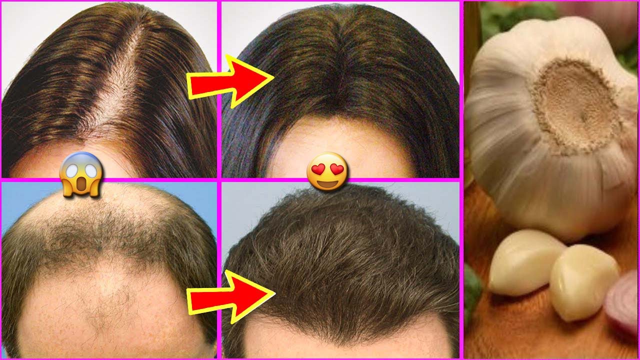 طريقة الحناء المعجزة لتطويل الشعر وعلاج الصلع والتساقط شعرك سينمو بجنون