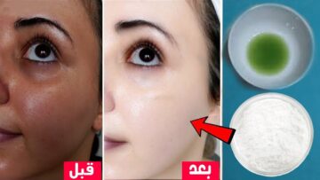 أقوي وصفة لتبييض البشرة والجسم للعرايس وإزالة سواد وبقع سنين من أول استعمال هتبقي زي القشطة