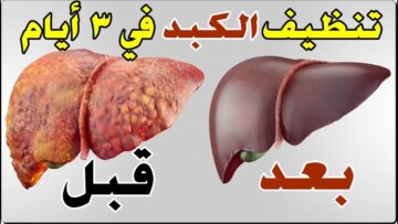 تعرف علي أهم المشروبات التي تنظف الكبد من السموم وتجدد خلاياه والابتعاد عن أضراره