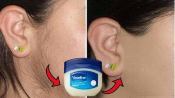 طريقة الفازلين السحرية لإزالة الشعر الزائد نهائيا من الوجه والجسم مع تبيض فوري