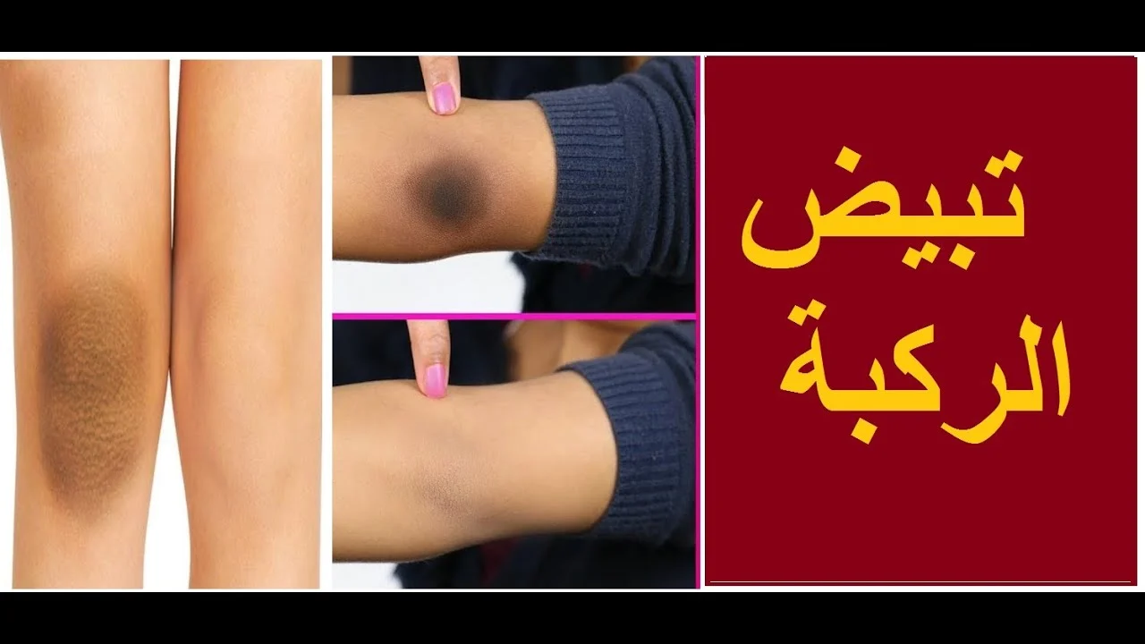 اقوي خلطة لتفتيح الركبتين والكوعين في اسرع وقت والنتيجه جباره 5 اقوي خلطة لتفتيح الركبتين والكوعين في اسرع وقت والنتيجه جباره