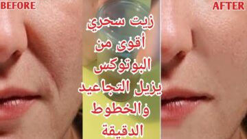 أقوى من البوتكس … زيت سحري للتجاعيد هيخفيها من أول مرة وتحدي