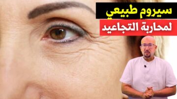 سيروم طبيعي للتجاعيد هيمسح التجاعيد مسح جربي ومش هتندمي