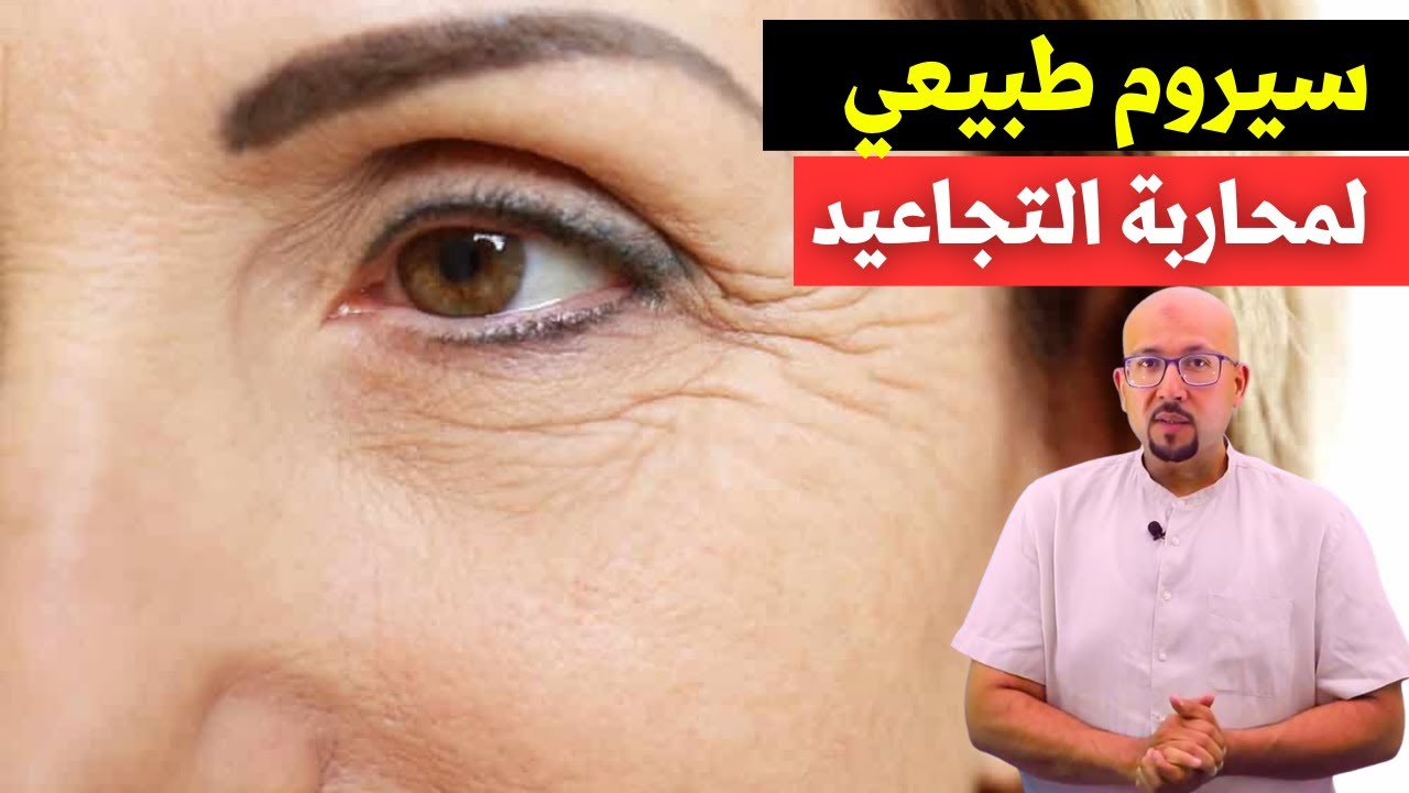 سيروم طبيعي للتجاعيد هيمسح التجاعيد مسح جربي ومش هتندمي 5 سيروم طبيعي للتجاعيد هيمسح التجاعيد مسح جربي ومش هتندمي