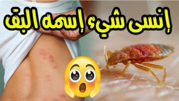 “الحشرة الي حيرتك”.. طرق التخلص من البق تماماً من العفش والأغطية والملابس