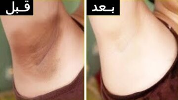 وصفات طبيعية لتفتيح المناطق الحساسة والتخلص من الاسمرار