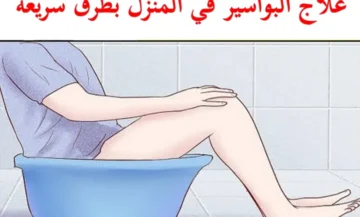 طرق إزالة البواسير بدون عملية جراحية وبطرق طبيعية علاج البواسير الداخلية والخارجة