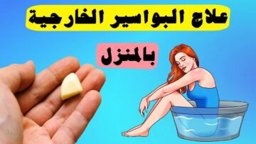 أقوي وأسرع طرق علاج البواسير في المنزل تعرف علي أعراضها وطرق علاجها بالمنتجات الطبيعية