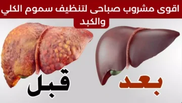 مشروب البقدونس المغلي صباحى لتنظيف الكبد وإابة حصوات الكلي وعلاج التهابات المسالك البولية