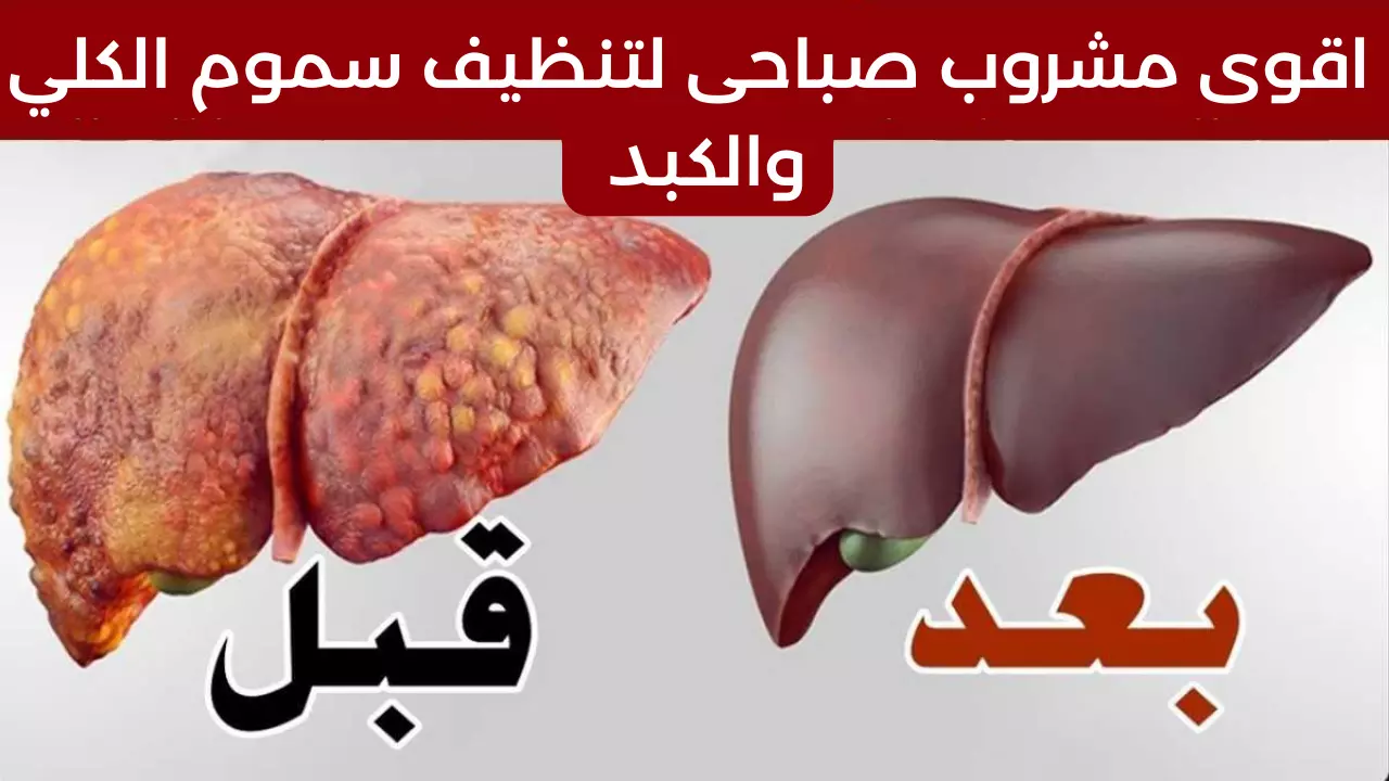 مشروب البقدونس المغلي صباحى لتنظيف الكبد وإابة حصوات الكلي وعلاج التهابات المسالك البولية 5 مشروب البقدونس المغلي صباحى لتنظيف الكبد وإابة حصوات الكلي وعلاج التهابات المسالك البولية