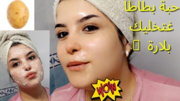البطاطس والنشا لشد البشرة كنز بين أيديك أقوى من البوتكس