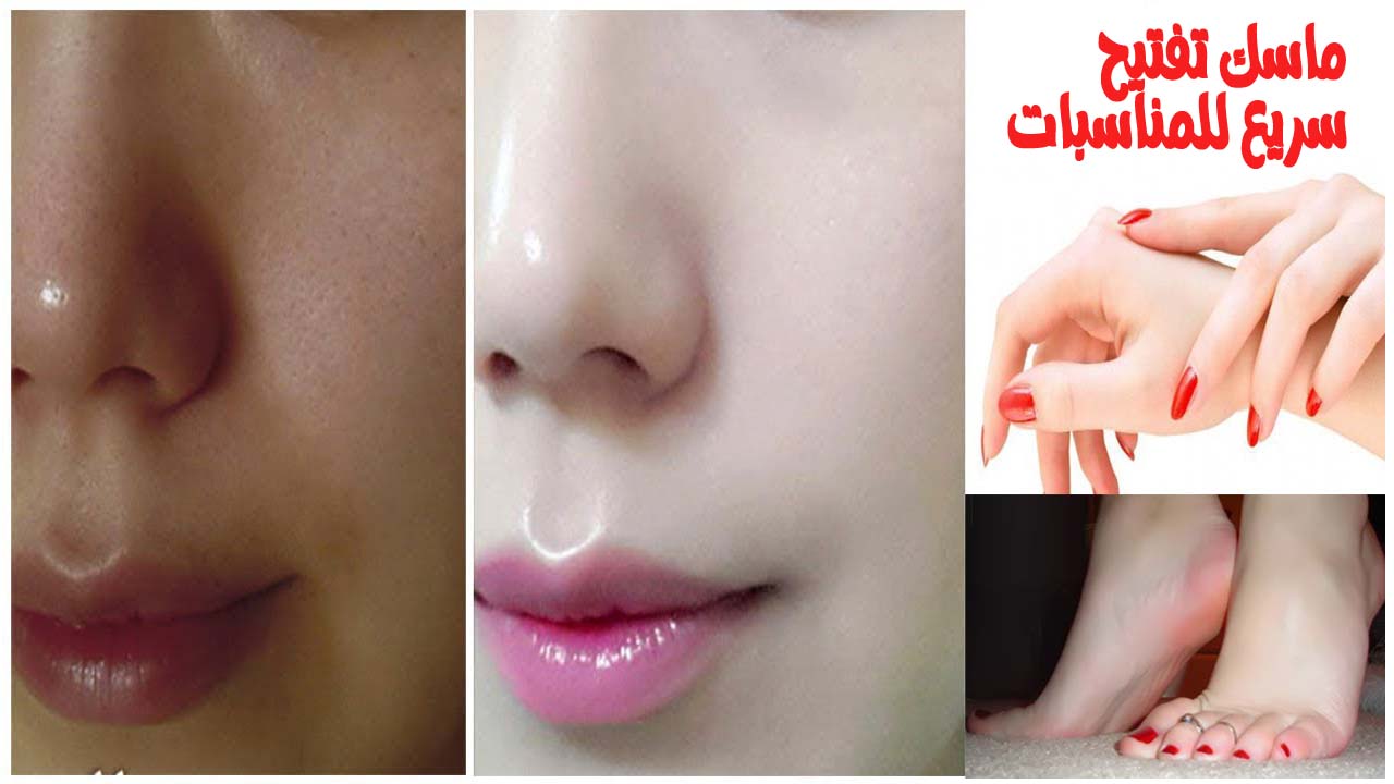 تعالى أقولك على خلطة التفتيح السريع للمناسبات بشرتك هتبقى فلتر 5 تعالى أقولك على خلطة التفتيح السريع للمناسبات بشرتك هتبقى فلتر