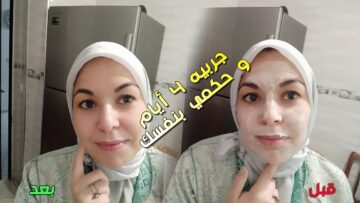 كريم البطاطس للوجه كريم رهيب تبييض من أول مرة وشد للبشرة
