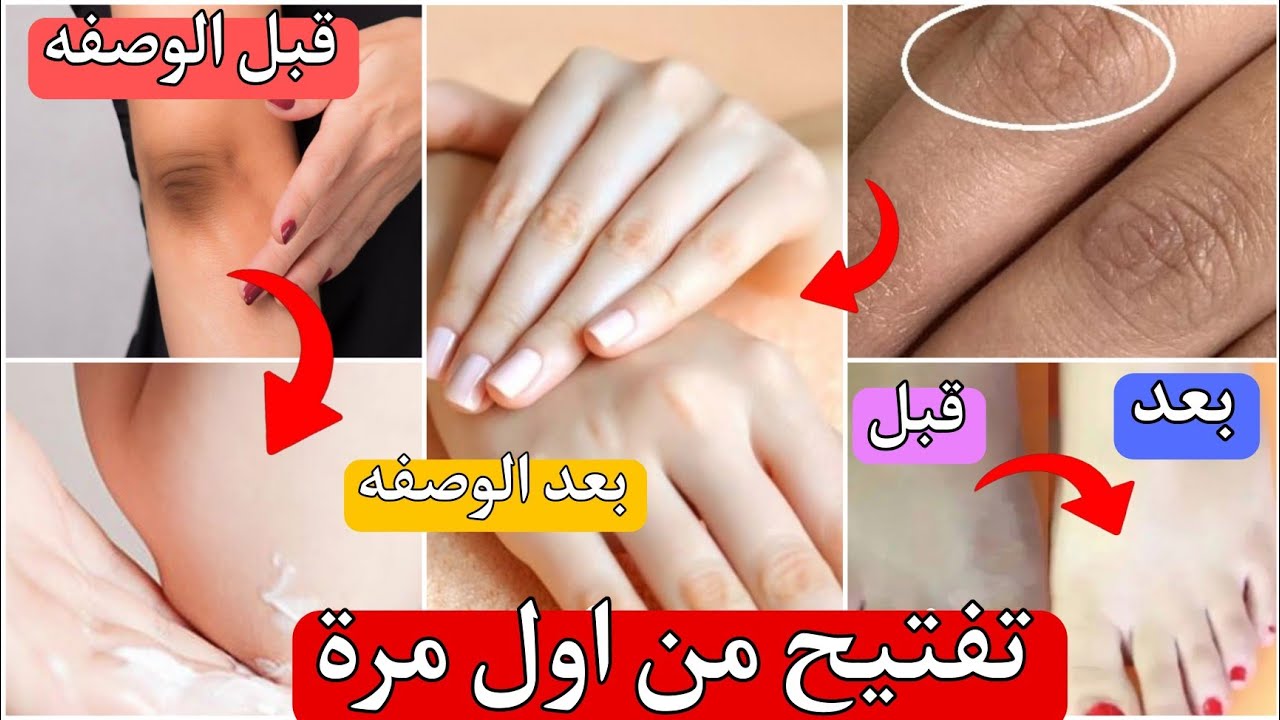 وصفات طبيعية لمقشر القدمين واليدين للمساعدة من التخلص من التشققات والخشونة والغمقان للتفتيح
