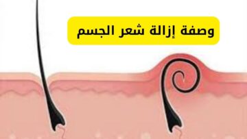 “مفيش ألم تاني”.. وصفة إزالة شعر الجسم في البيت بدون شيفنج ولا سويت وهيبقى جسمك ناعم