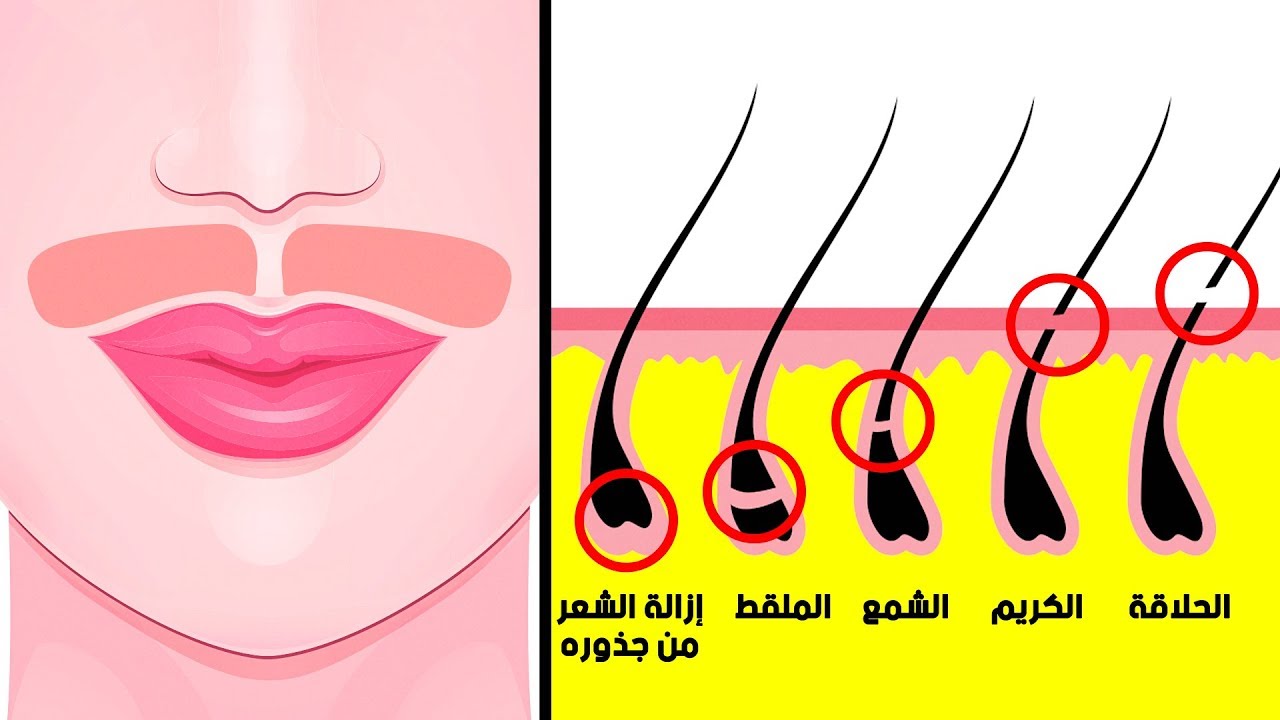 "من جدوره" وصفة إزالة شعر الوجه بمكونات طبيعية لبشرة ناعمة بديل الليزر السحري 5 “من جدوره” وصفة إزالة شعر الوجه بمكونات طبيعية لبشرة ناعمة بديل الليزر السحري