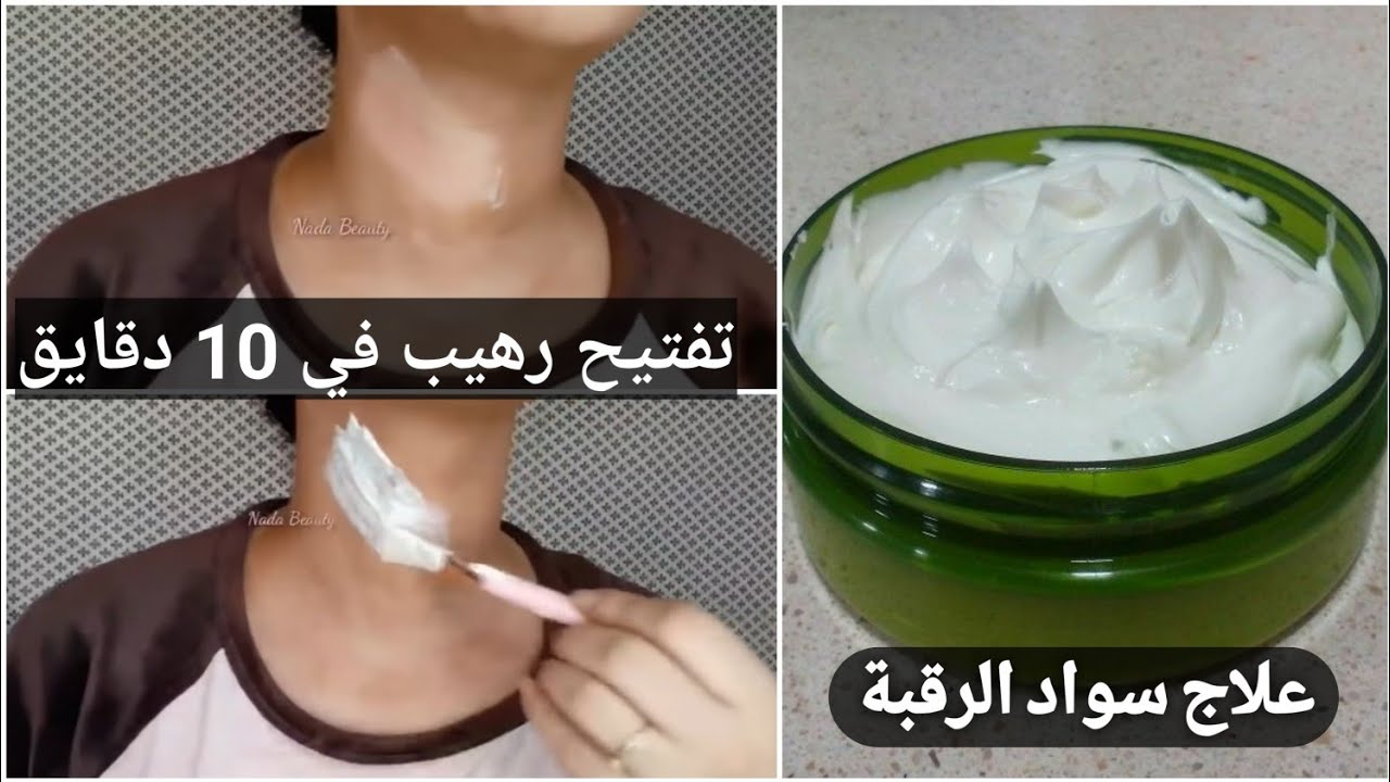 “رقبتك هتنور” وصفة تبييض الرقبة بـ 3 وصفات منزلية هتجيب من الآخر