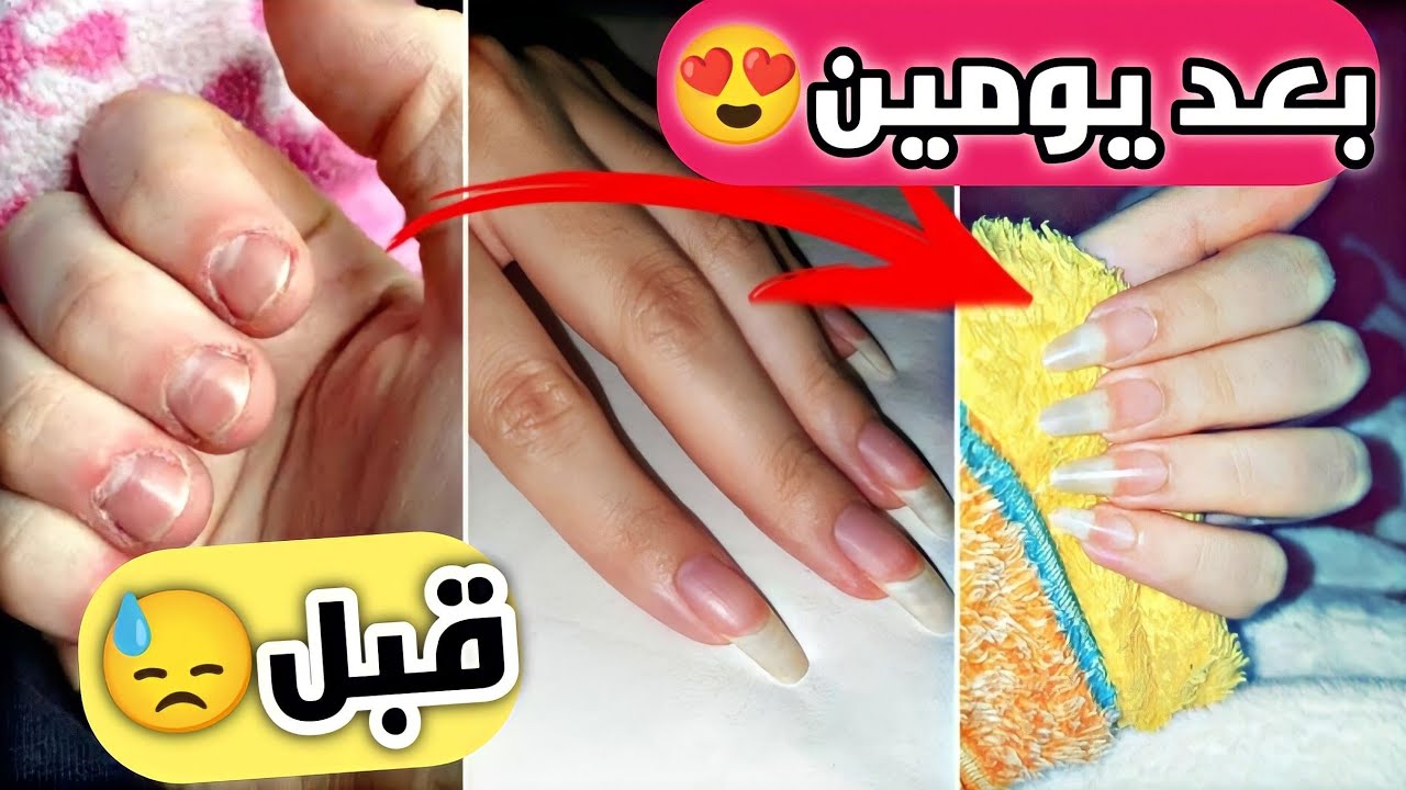 "مش هتحتاجي تركبي ظوافر".. وصفة تطويل الأظافر في يومين فقط وتقويتها كمان عشان متكسرش 5 “مش هتحتاجي تركبي ظوافر”.. وصفة تطويل الأظافر في يومين فقط وتقويتها كمان عشان متكسرش