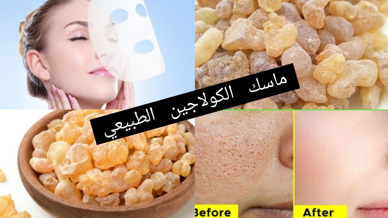 كولاجين طبيعي للبشرة للتخلص من التجاعيد والانكماش تماماً وهيشد بشرتك أحسن من الفيلر 5 كولاجين طبيعي للبشرة للتخلص من التجاعيد والانكماش تماماً وهيشد بشرتك أحسن من الفيلر