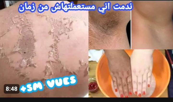 بشرتك هتتفتح 10 درجات عن الأول.. هتقشري بشرتك طبيعي في ثواني أقوي ماسك مقشر للبشرة الحساسة لازالة الجلد الميت 5 بشرتك هتتفتح 10 درجات عن الأول.. هتقشري بشرتك طبيعي في ثواني أقوي ماسك مقشر للبشرة الحساسة لازالة الجلد الميت