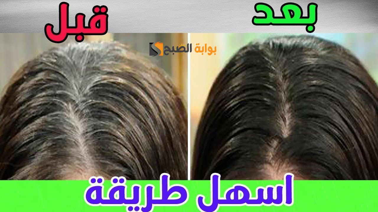 هيبقى أسود ليل .. أفضل طريقة للتخلص من الشعر الأبيض وإزالة الشيب من الشعر نهائياً في أقل من 72 ساعة "كشف سر المعجزة السحرية للخل" 5 هيبقى أسود ليل .. أفضل طريقة للتخلص من الشعر الأبيض وإزالة الشيب من الشعر نهائياً في أقل من 72 ساعة “كشف سر المعجزة السحرية للخل”
