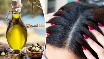 ودعي القشرة للأبد في يومين وبس.. الحل السريع للتخلص من قشرة الشعر بمكونات طبيعية وفي وقت قياسي “هتخلصى من الإحراج نهائيا”