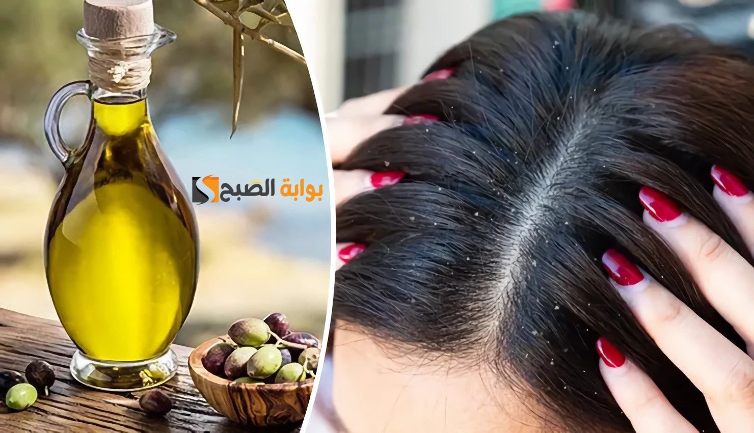 ودعي القشرة للأبد في يومين وبس.. الحل السريع للتخلص من قشرة الشعر بمكونات طبيعية وفي وقت قياسي "هتخلصى من الإحراج نهائيا" 5 ودعي القشرة للأبد في يومين وبس.. الحل السريع للتخلص من قشرة الشعر بمكونات طبيعية وفي وقت قياسي “هتخلصى من الإحراج نهائيا”