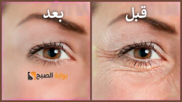 اسرار الكولاجين .. أسرع طريقة لعمل أرخص كولاجين للبشرة يجعلك تبدين أصغر بعشر سنوات “فوائد لا تنتهي لزيت شجرة الشاي”