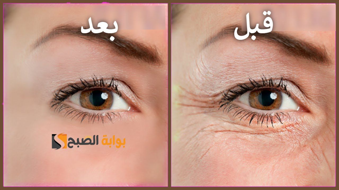 اسرار الكولاجين .. أسرع طريقة لعمل أرخص كولاجين للبشرة يجعلك تبدين أصغر بعشر سنوات "فوائد لا تنتهي لزيت شجرة الشاي" 5 اسرار الكولاجين .. أسرع طريقة لعمل أرخص كولاجين للبشرة يجعلك تبدين أصغر بعشر سنوات “فوائد لا تنتهي لزيت شجرة الشاي”