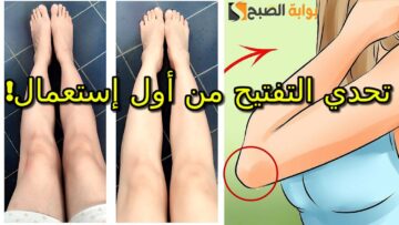 حققي حلمك بـ 10 جنيه .. كريم الليمون مع الفازلين وصفة على قد الإيد لتفتيح الركب والأكواع في أقل من أسبوع ” رجلك هتنور من البياض”