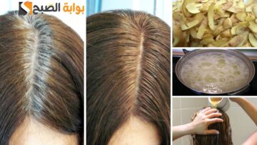 كنز في بيتك وأغلى من الذهب.. وصفة قشر البطاطس هتحللك نص مشاكل شعرك ” مش هترمي القشر مرة تانية”