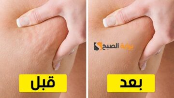 للعرايس وبس ممنوع دخول الرجال.. وصفات طبيعية مختلفة لتقشير الجسم بالكامل مع إزالة السيلوليت والجلد الميت” النتيجة برة الصندوق”
