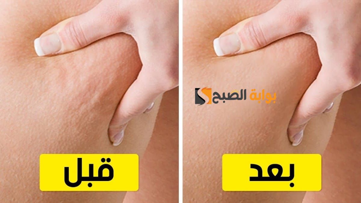 للعرايس وبس ممنوع دخول الرجال.. وصفات طبيعية مختلفة لتقشير الجسم بالكامل مع إزالة السيلوليت والجلد الميت" النتيجة برة الصندوق" 5 للعرايس وبس ممنوع دخول الرجال.. وصفات طبيعية مختلفة لتقشير الجسم بالكامل مع إزالة السيلوليت والجلد الميت” النتيجة برة الصندوق”