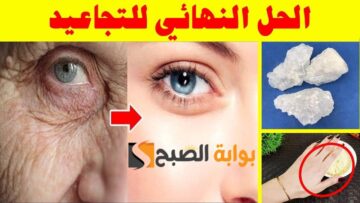 وصفة جدتي قالتلي عليها .. زغللي عيون الكل بجمالك “طريقة لعمل بوتكس طبيعي في البيت لشد البشرة” هتصغري ١٠ سنين من عمرك
