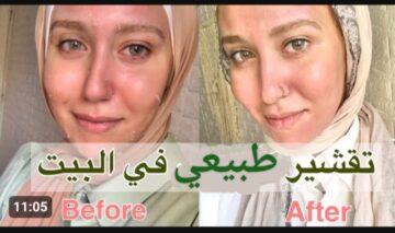« لو روحتى لمحل كوافير هياخد منك ايش وشويات » .. مقشر للوجه طبيعي ومن البيت