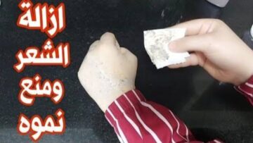 نضافة اكيدة من غير الم.. مكون طبيعي لإزالة الشعر الزائد من جدوره خلال 5 دقايق