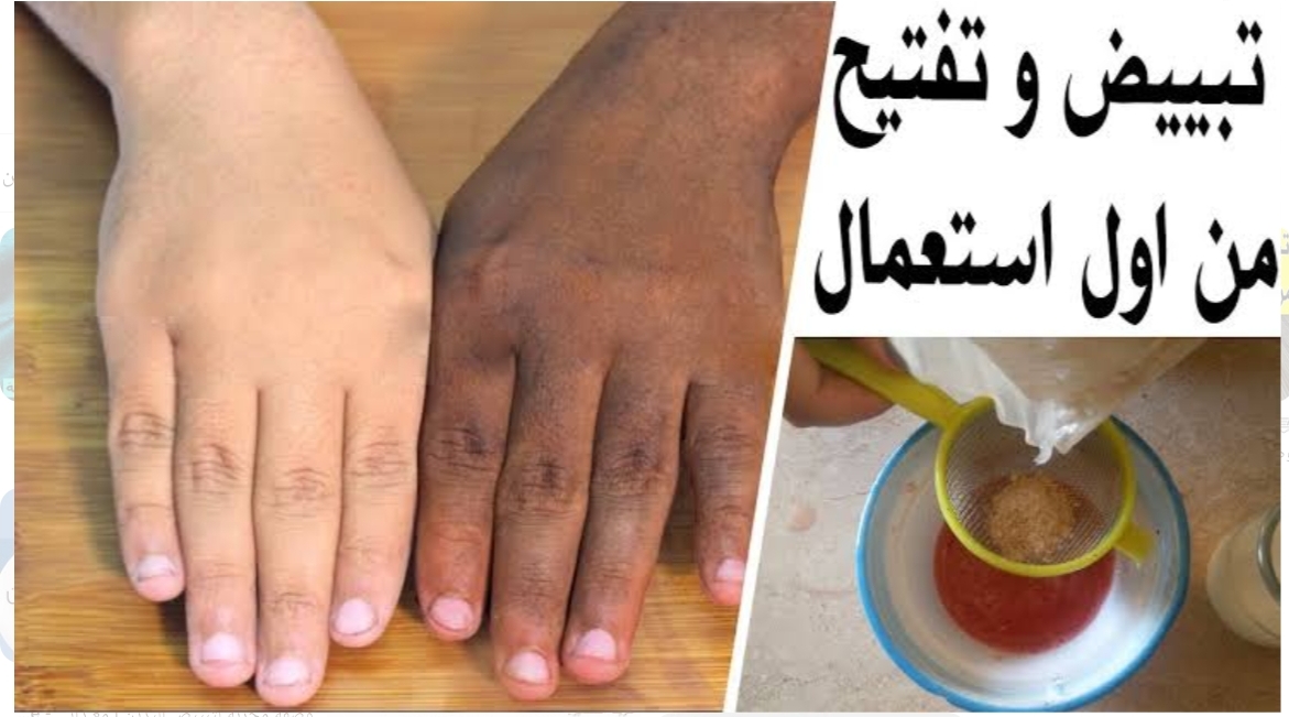 وصفة فعالة في تفتيح اليدين بشكل سريع وآمن تماما لبشرة خالية من العيوب